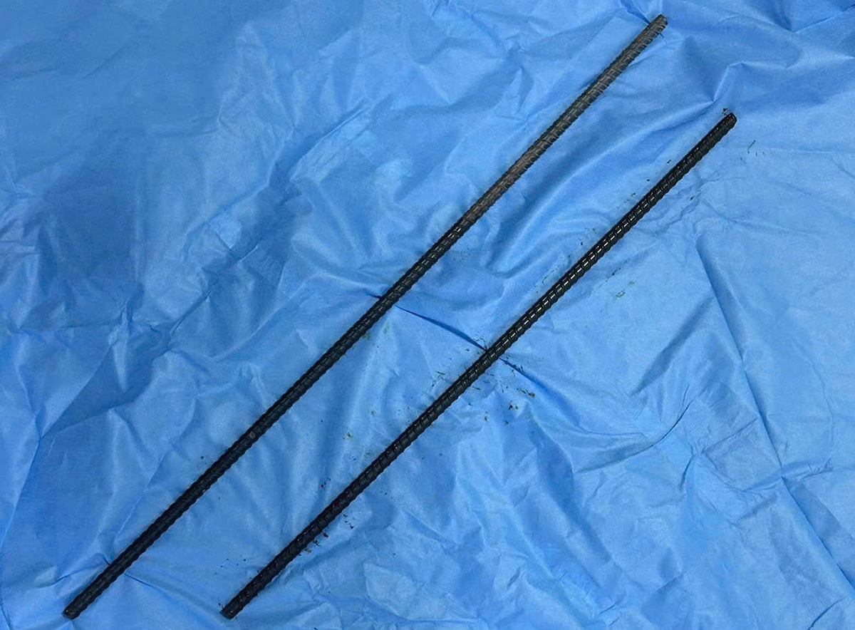 Man saved after two iron rods pierce his body