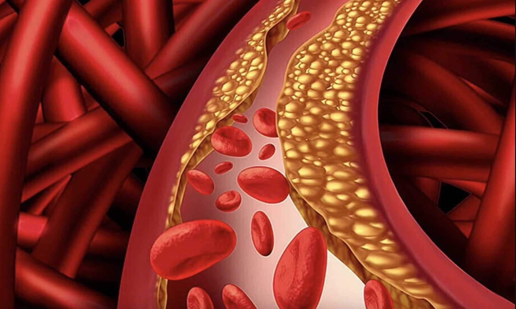 Japanese doctor warns of three blood types that can 'trigger' stroke