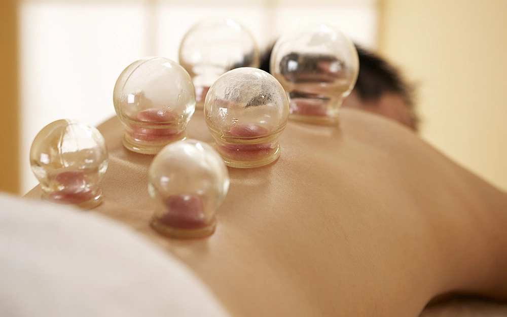 Can cupping and bloodletting cure stroke?