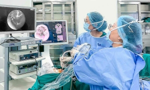 4th sinus surgery for a woman