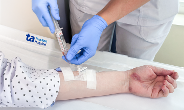 Biologic drug infusions prevent lupus flares
