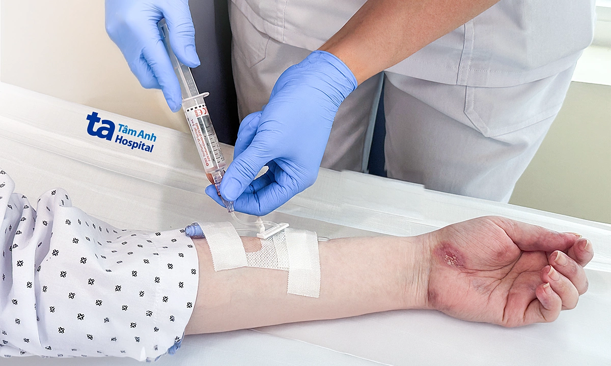 Biologic drug infusions prevent lupus flares