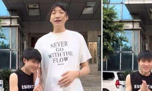 2,2-meter-tall tiktoker passes away due to rare disease complications