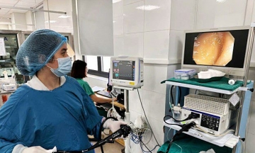 70 cm beef tapeworm discovered during colonoscopy