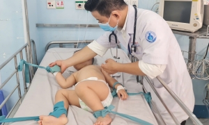 Hand, foot, and mouth disease cases in Ho Chi Minh City increase by nearly 48%