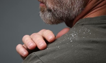 25 dandruff flakes on a mask help police solve 11-year-old robbery