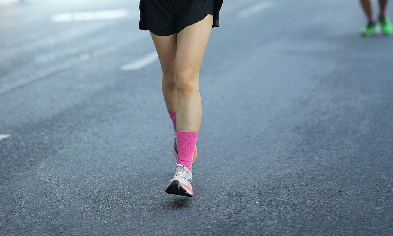 Does running cause varicose veins?